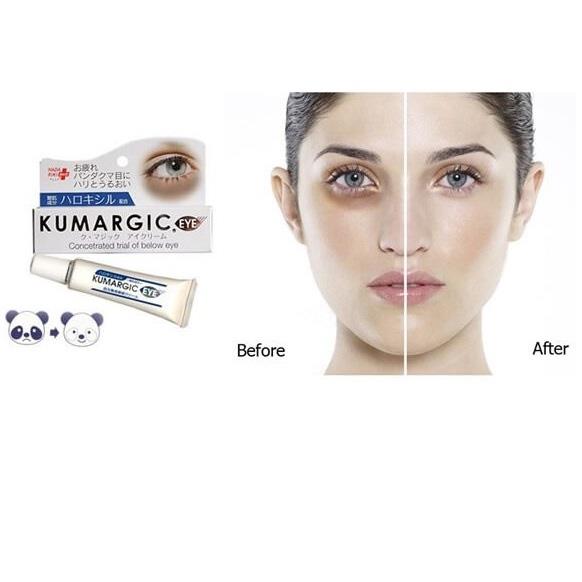 Kem trị thâm quầng mắt Kumargic Nhật (Tuýp)