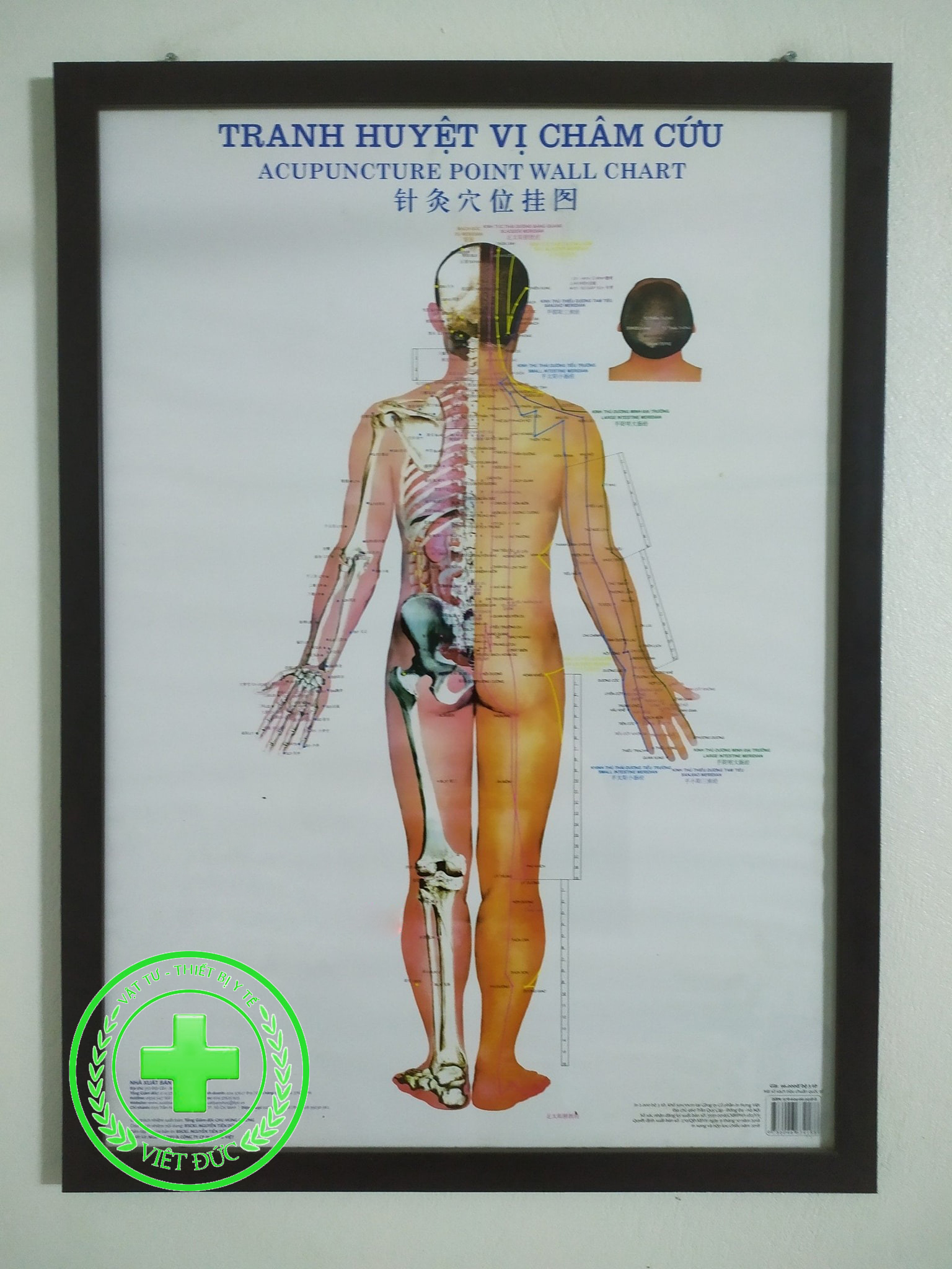 Tranh châm cứu huyệt vị