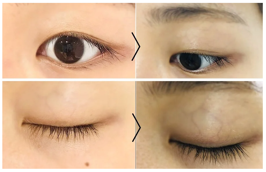 Tinh Chất Dưỡng Mi Etude House My Lash Serum
