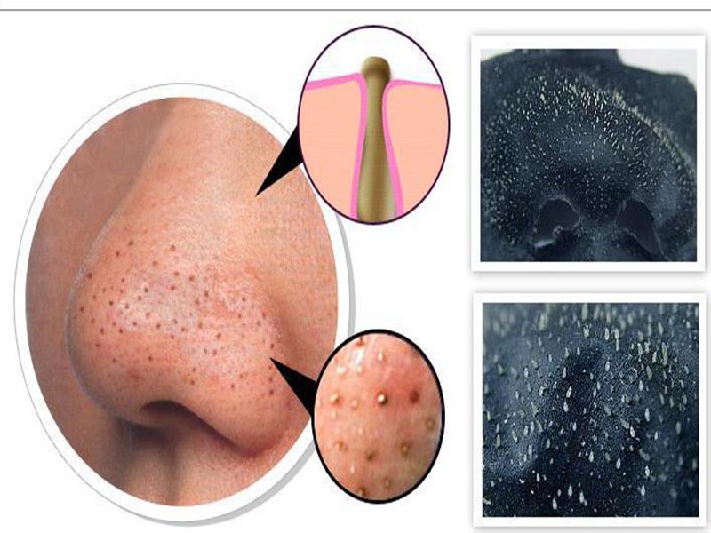 Gel lột mụn Black Head Mistine
