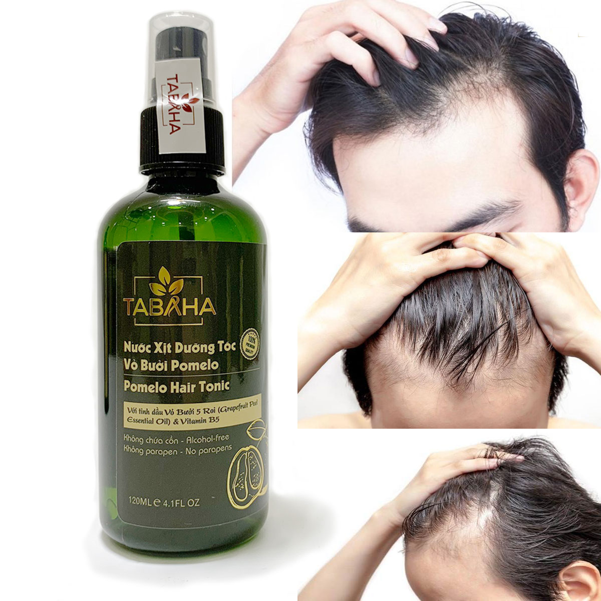 [HCM]Liệu trình ngăn rụng tóc 2 chai xịt mọc tóc Pomelo Tabaha 120ml