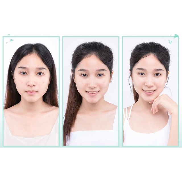 Gel Rửa Mặt Eucerin Cho Da Nhờn Mụn Eucerin ProAcne Solution Cleansing Gel Hasaki Sản Phẩm Chính Hãng