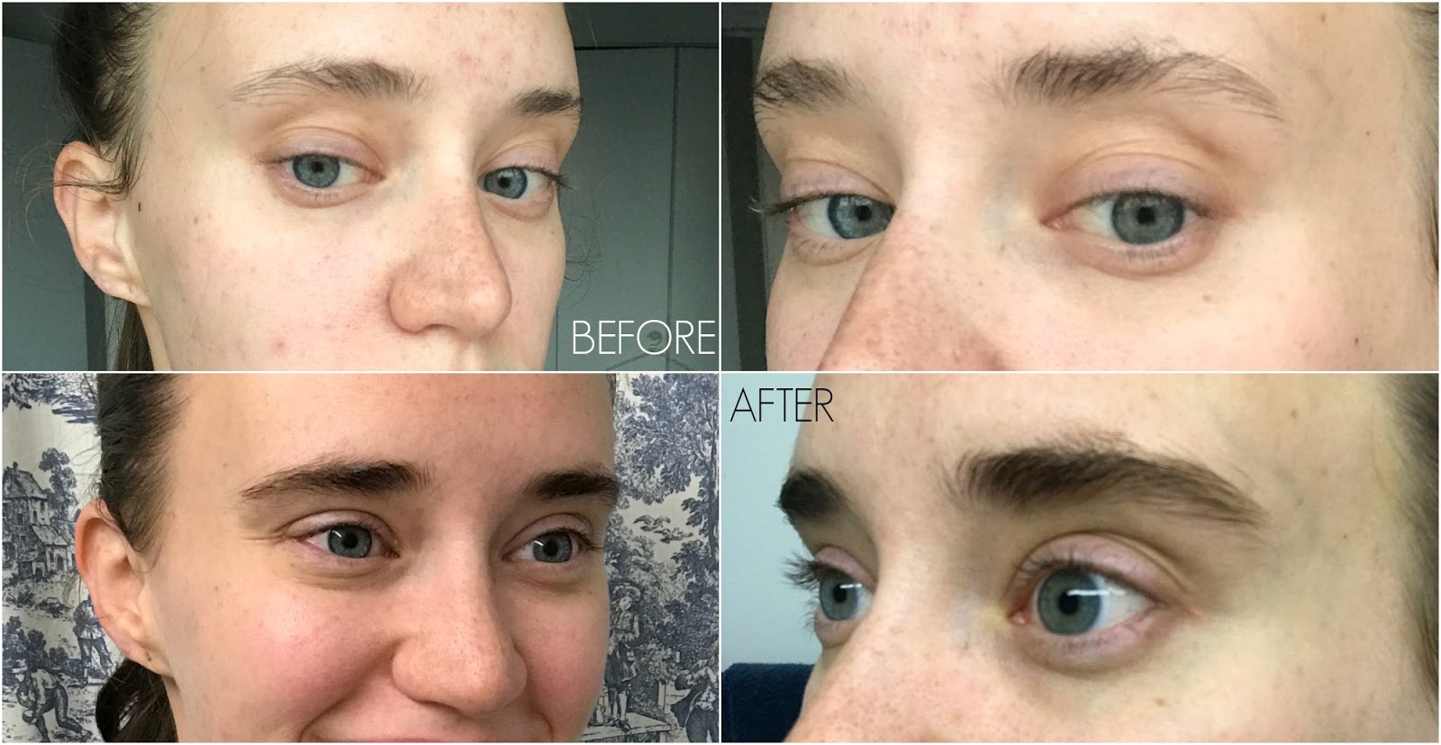 Serum Giúp Dưỡng Dài Và Dày Lông Mày RevitaBrow Advanced 0.9ml