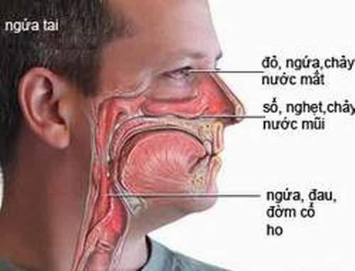 [HCM]BÌNH RỬA MŨI CHO BÉ VÀ NGƯỜI LỚN VSS – THÁO SET CHỈ CÓ BÌNH