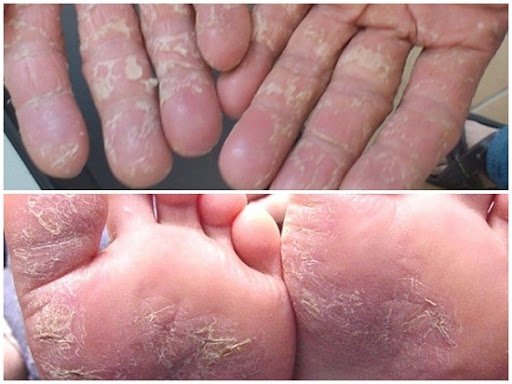 [Mẫu Mới] Kem bôi da Thuần Mộc Thanh Mộc Hương 16g, tặng kèm chai xịt kháng khuẩn