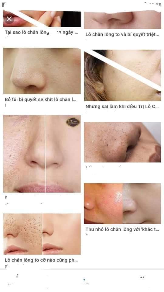 DƯỠNG DA TRẦN KIM HUYỀN - 0183