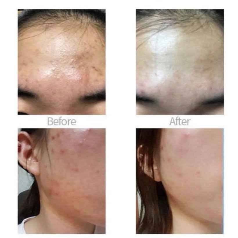 [ CELLMULA ] Kem Chấm Mụn Cellmula Ac Clear Spot