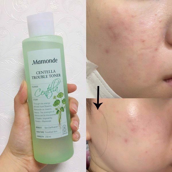 Nước Hoa Hồng Mamonde Mini 25ml [Hoa Hồng - Diếp Cá]
