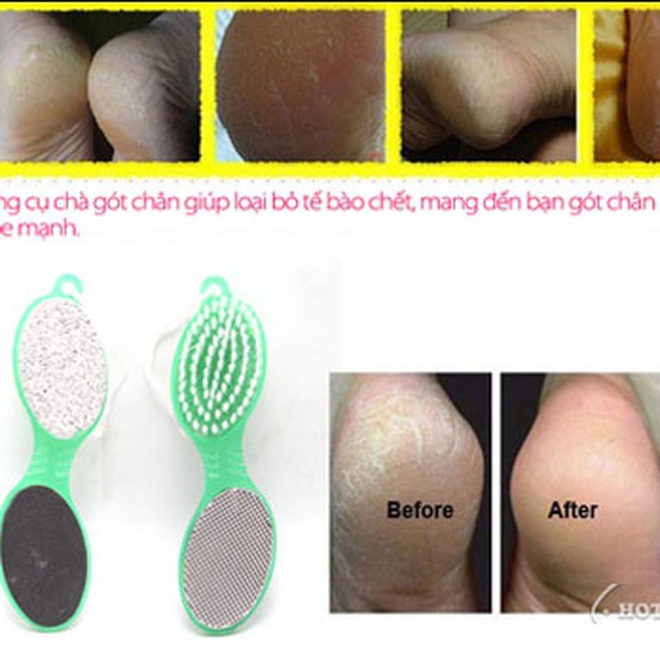 Dụng cụ chà gót chân 4in1 tiện lợi