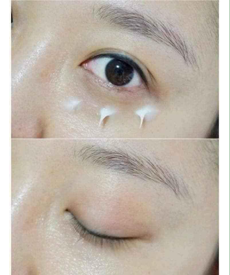 Kem Dưỡng Vùng Mắt Atomy The Fame Eye Cream Giảm Nếp Nhăn, Làm Sáng, Căng Mịn Da Mắt