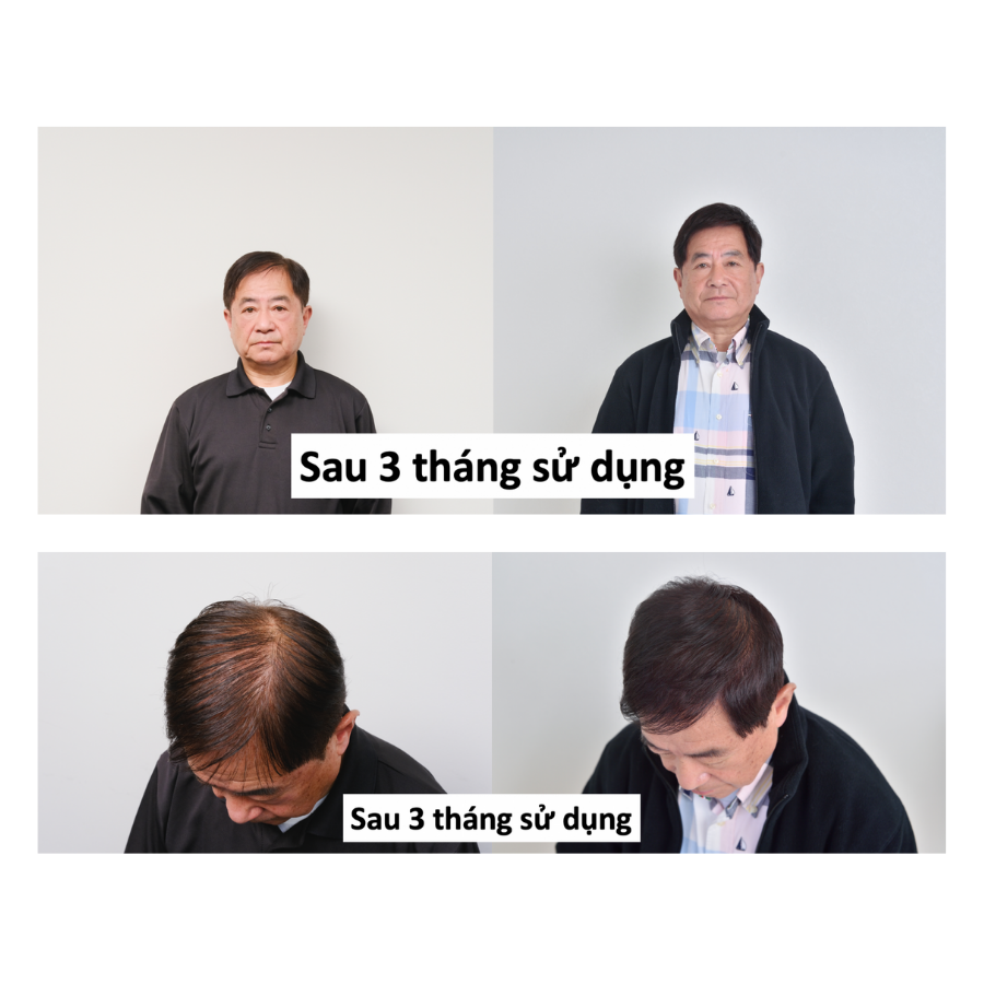 Xịt dưỡng tóc kích thích mọc tóc Nhật Bản Newmo 75ML