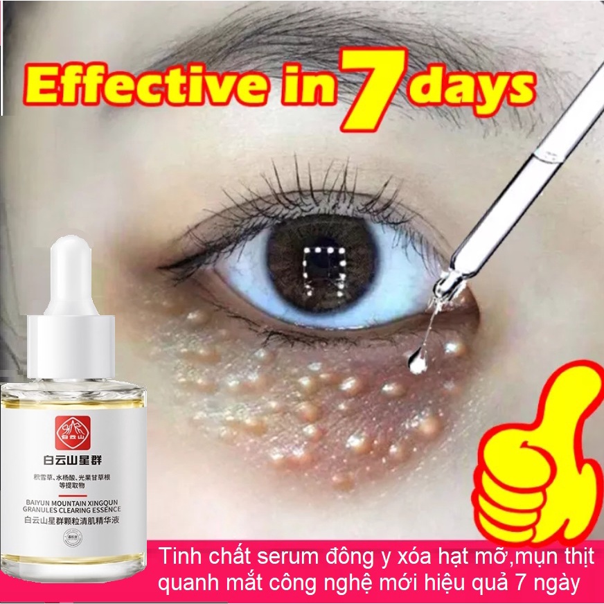 Tinh chất serum loại bỏ và xóa mụn thịt,mụn hạt mỡ quanh mắt
