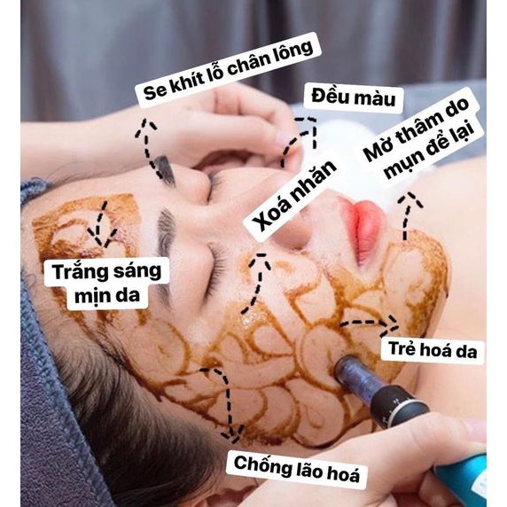 Cấy Hồng Sâm Gogo Hàn Quốc Cao Cấp