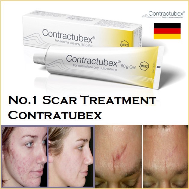 (Có Bill - nội địa Đức) Kem làm mờ sẹo Contractubex 30g