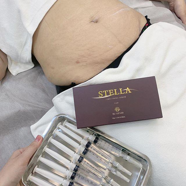 [HCM]STELLA TAN MỠ VIP CHUẨN HÀN