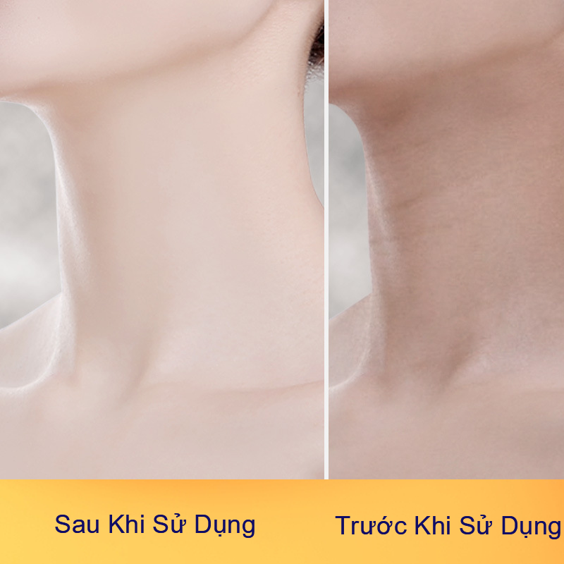COMBO ĐÁNH BAY MỤN THẢNH THƠI