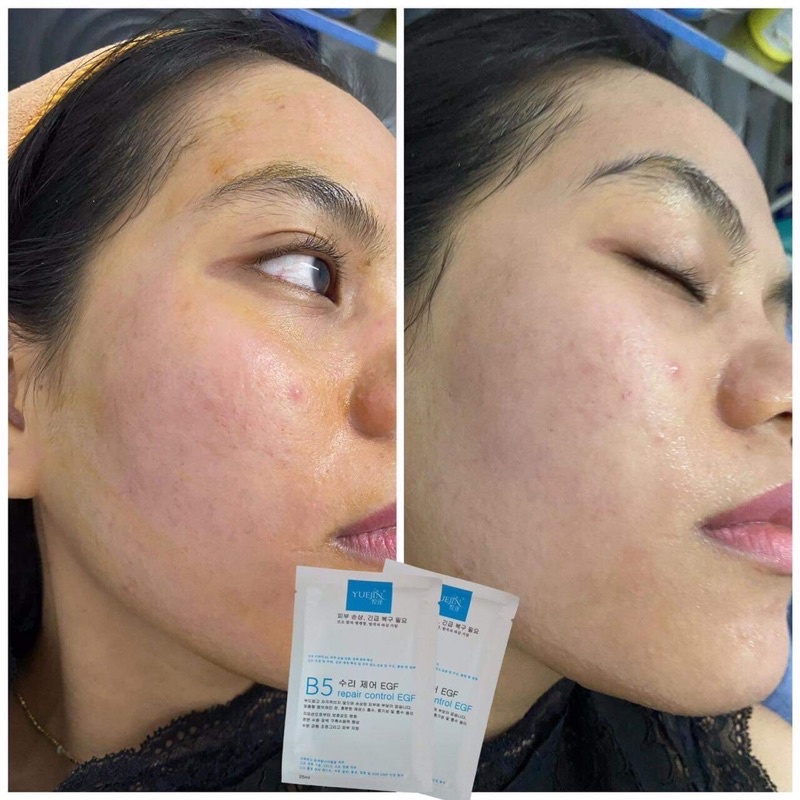 [Free Ship] [Hot] Mặt nạ Yuejin B5 cấp ẩm, phục hồi da
