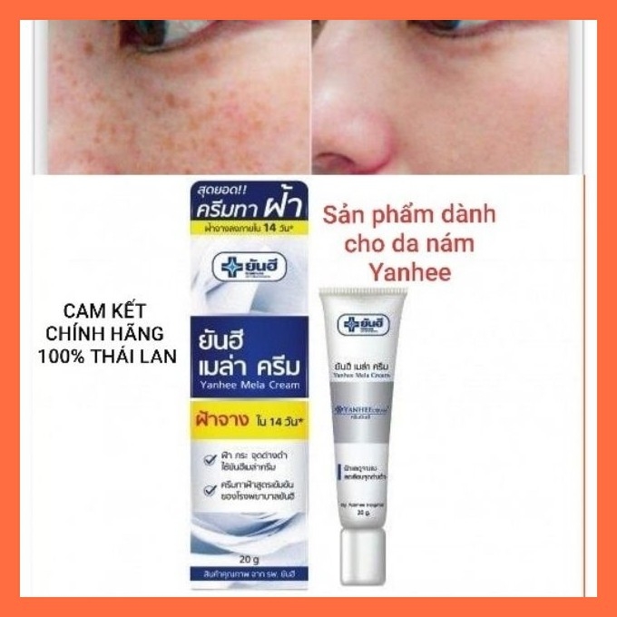 [HCM]Kem Xóa Thâm Nám Đồi Mồi Tàn Nhang YANHEE Thái Lan