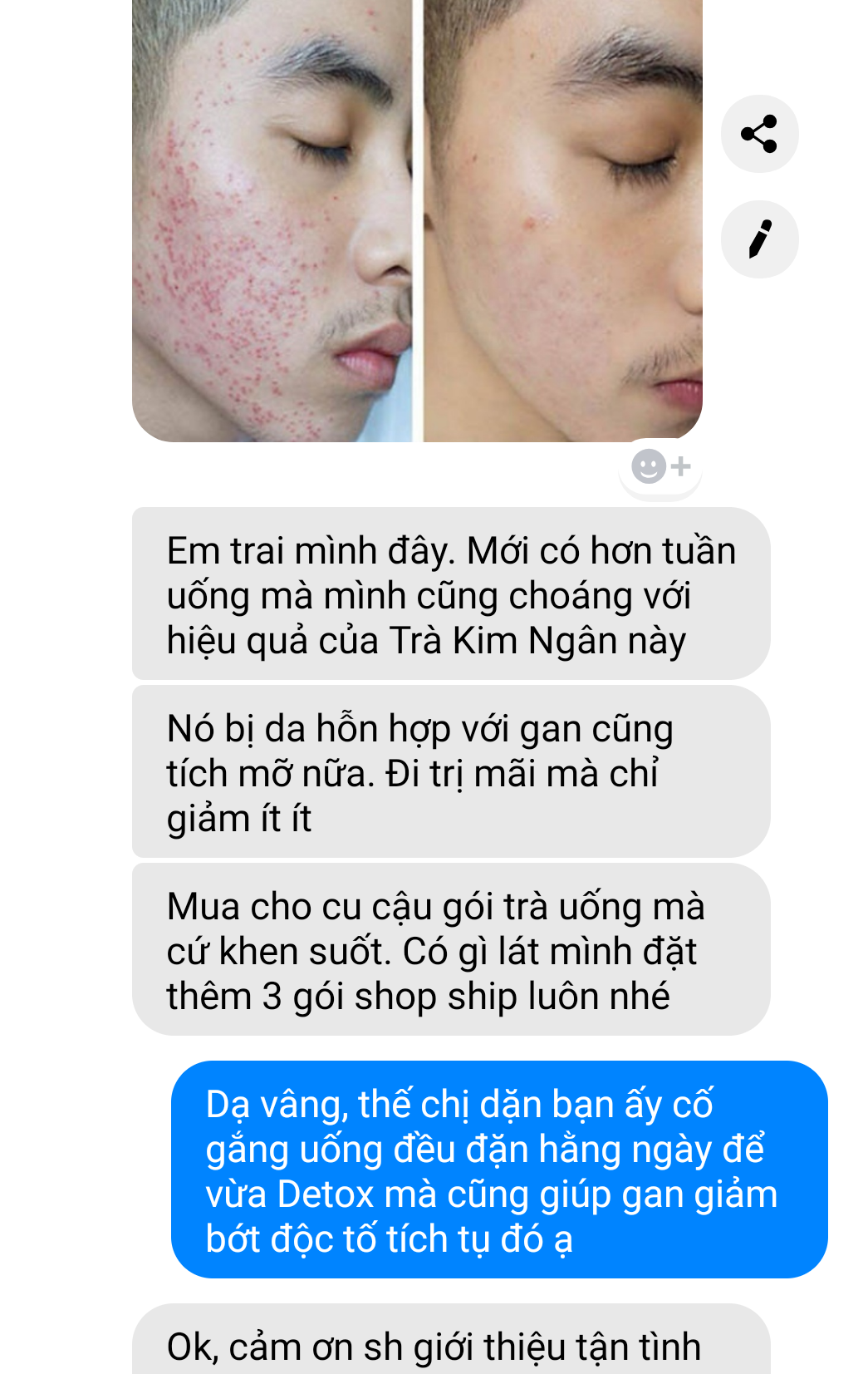 [CHÍNH HÃNG] Trà Detox Hoa Kim Ngân Thải Độc Gan, Thanh Nhiệt, Giải Mụn Nhọt 100g (Loại Đẹp)