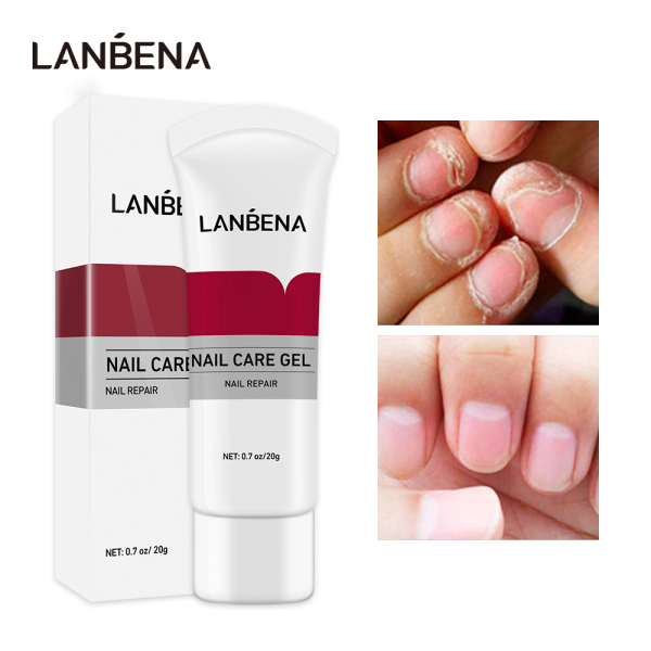 LANBENA Gel sửa chữa móng tay Điều trị nấm móng Loại bỏ nấm móng Dưỡng móng Chăm sóc tay và chân giá rẻ