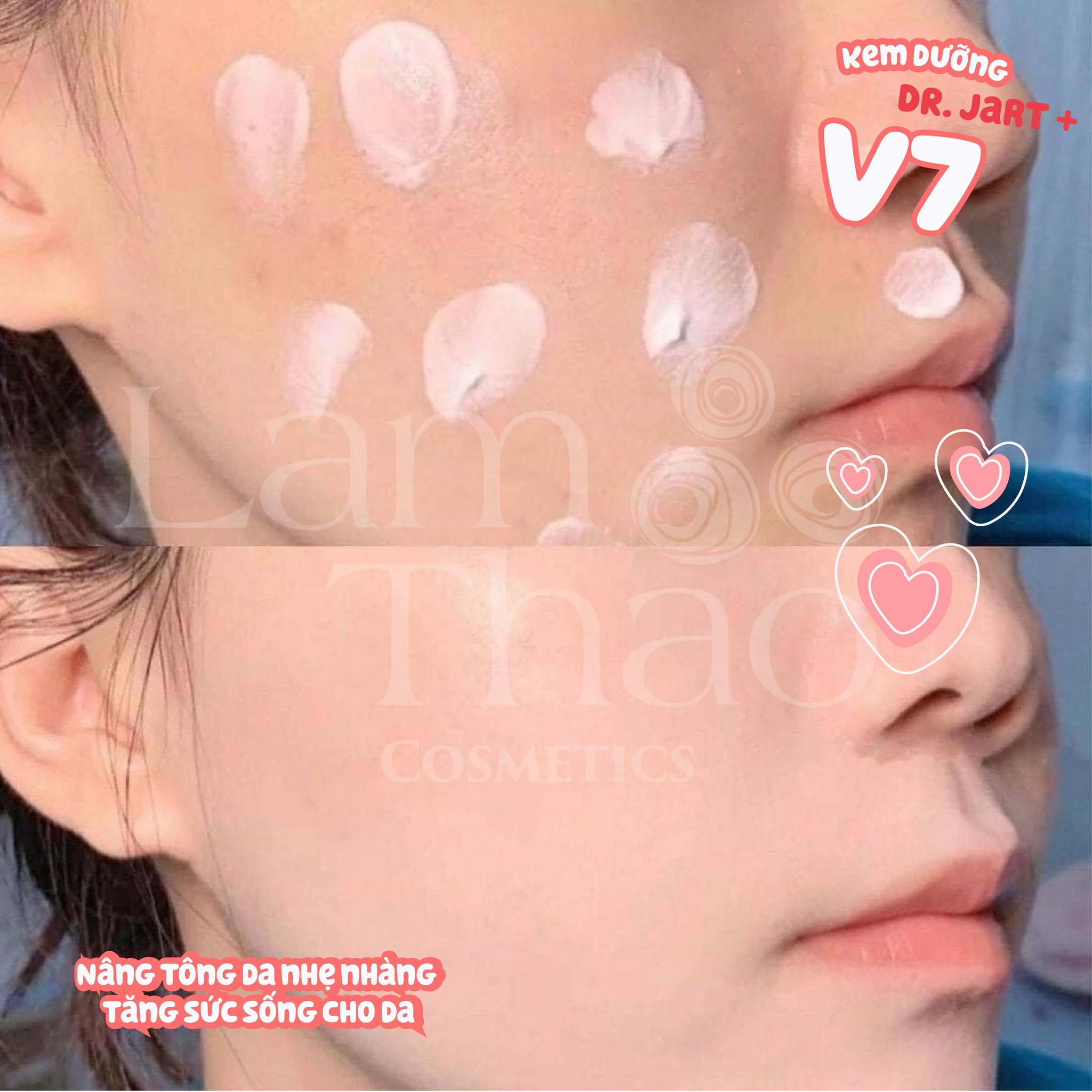Kem Dưỡng Dr. Jart+ V7 15ml
