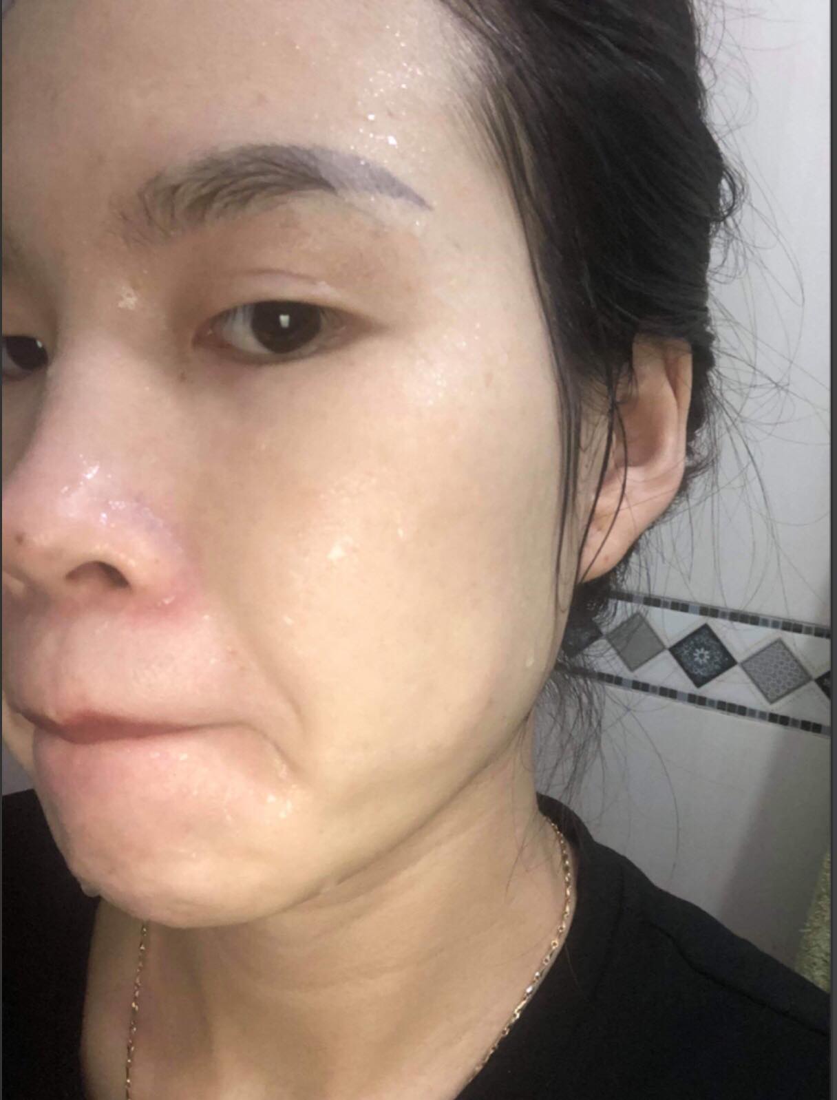 Cỏ trị nám, tàn nhang Lý Gia .