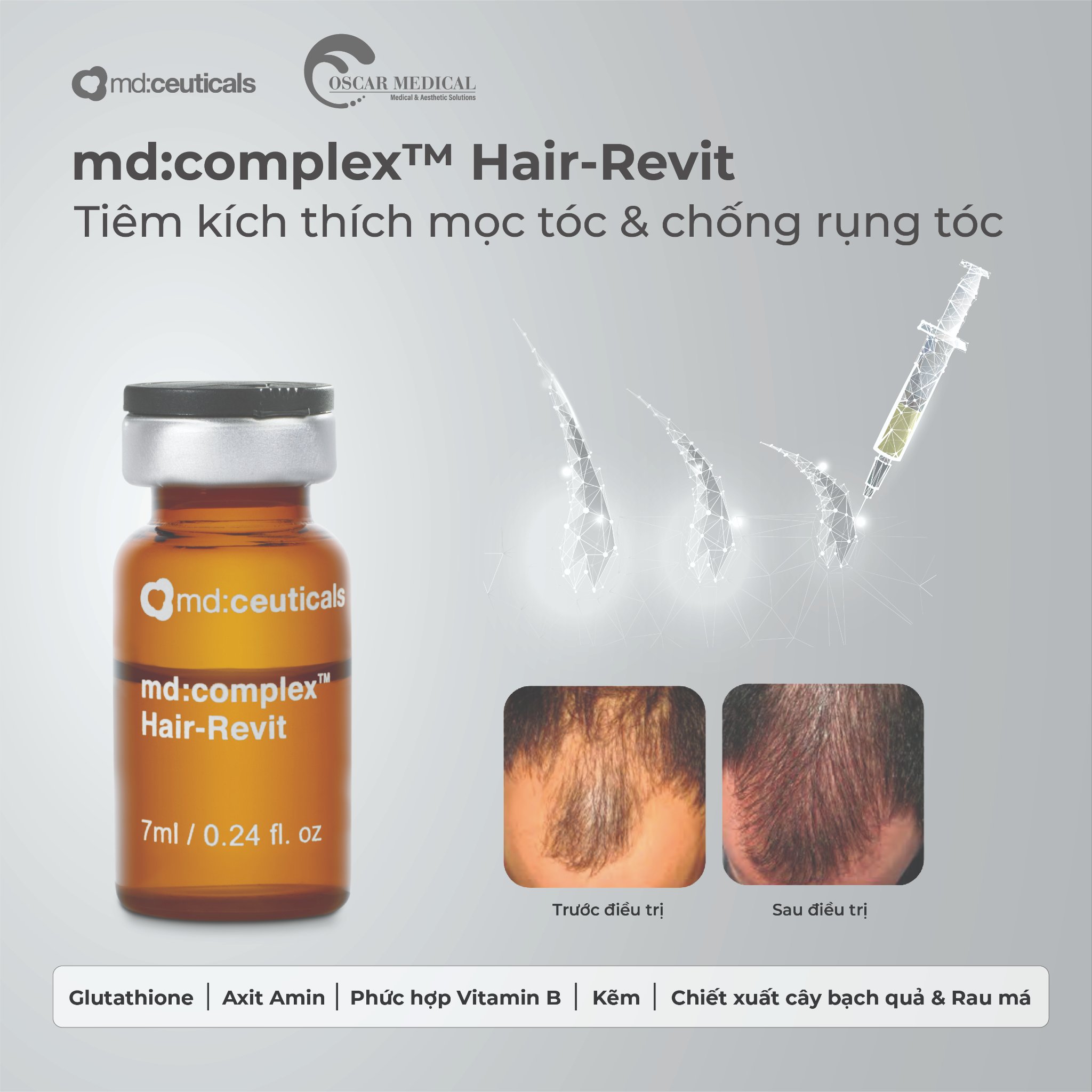 Md:Complex Hair-Revit – Meso MD Ceuticals chống rụng tóc & Kích thích mọc tóc | Meso cosmetic