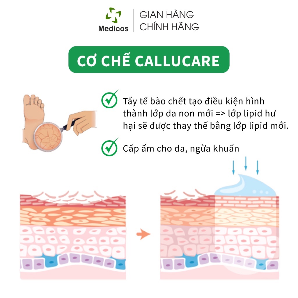 [HCM]Kem Bôi Nứt Gót Chân Medicosh Callucare 50ml