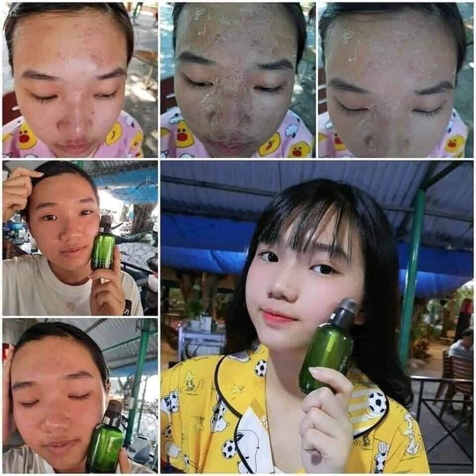 Serum Tái Tạo Da Nhân Sâm MQ SKIN 80ml