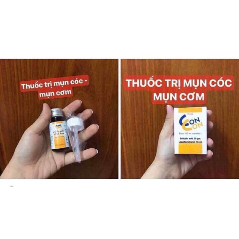 Chấm Mụn Cơm Mụn Cóc Concon Thái Lan