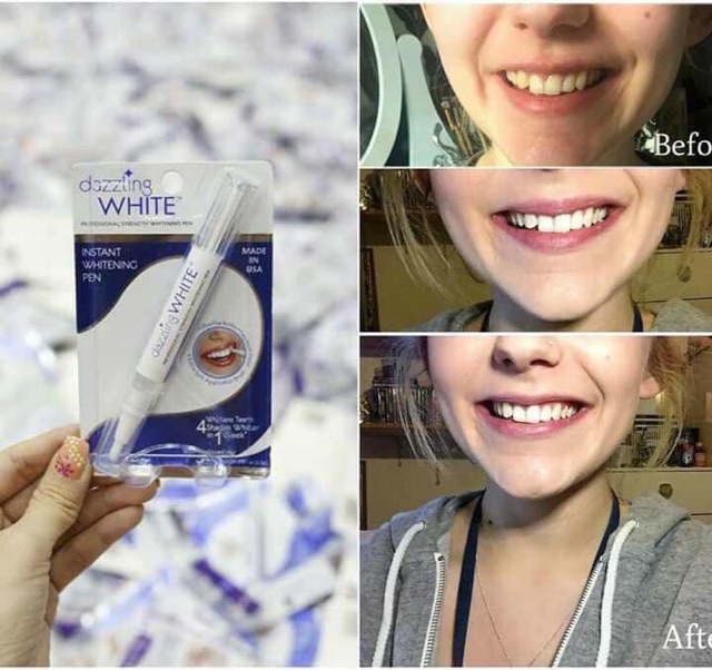 Bút Trắng Răng Dazzling White- Lấy Sỉ Ib