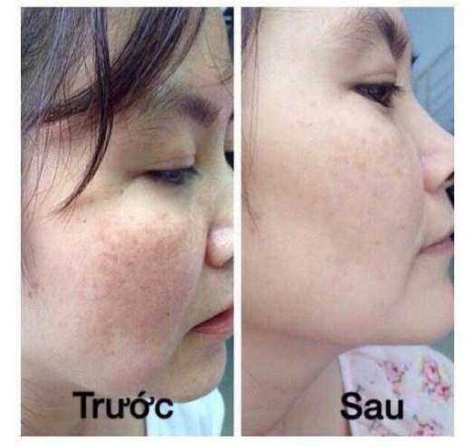 Gel Kỳ Da Chết Cà Phê Cao Cấp - Mẫu mới