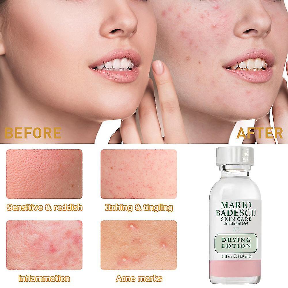 Chấm mụn cấp tốc Mario Badescu Drying Lotion