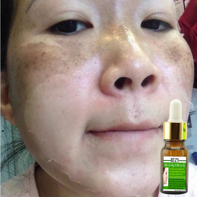 Lột BEZY Tái Tạo Da Mặt Hết Nám Thâm Sạm