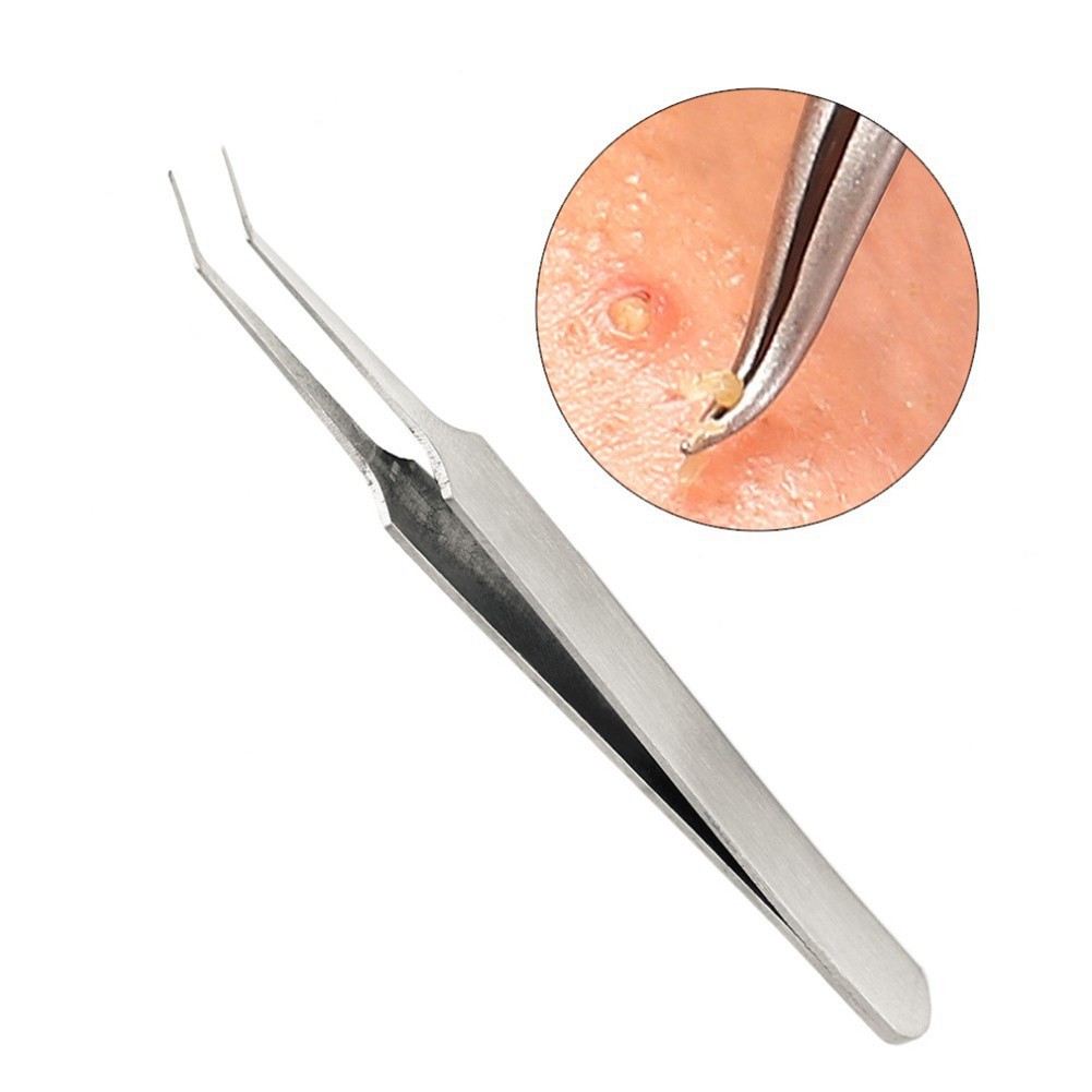 [HCM]Bộ 3 Nhíp Gắp Mụn Đầu Đen Mụn Dưới Da