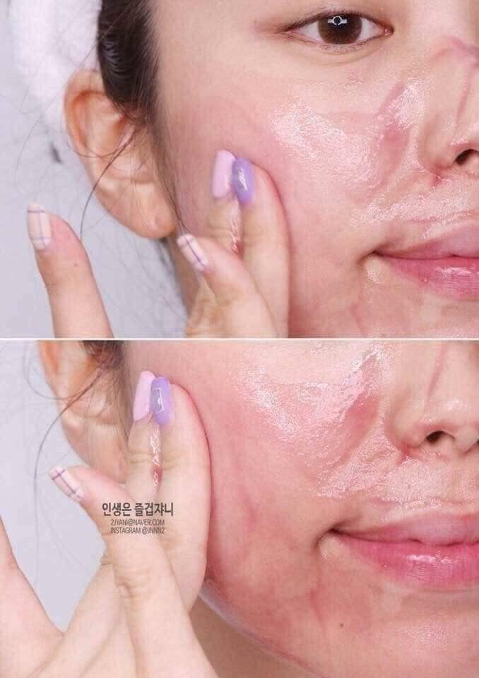 Thay Da Sinh Học RED PEEL TINGLE SERUM (Dạng gói)