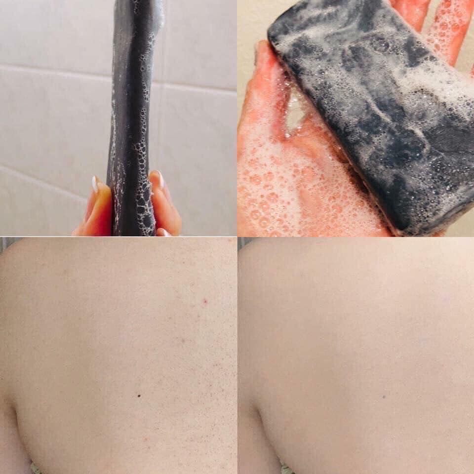 Xà phòng giảm mụn lưng Pelican For Back 135g