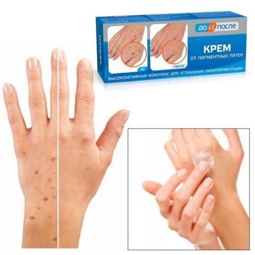 Kem đồi mồi Kpem Nga 50ml