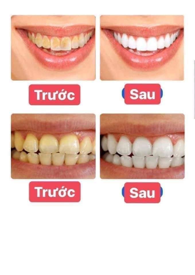 [HCM]Kem Đánh Răng Baking Soda