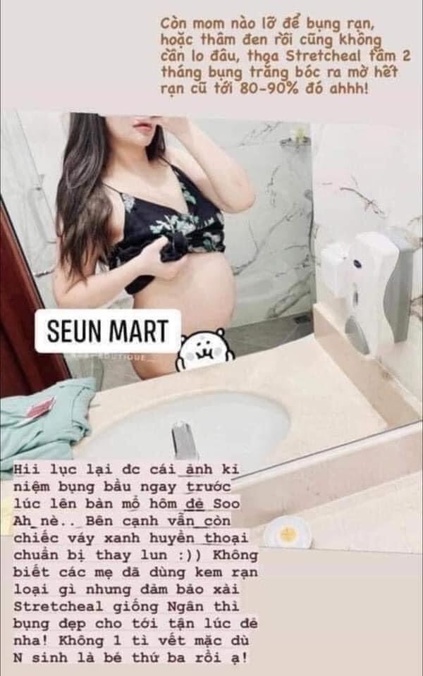 [GIẢM 5% ĐƠN 129K]Kem dưỡng da rạn StretcHeal