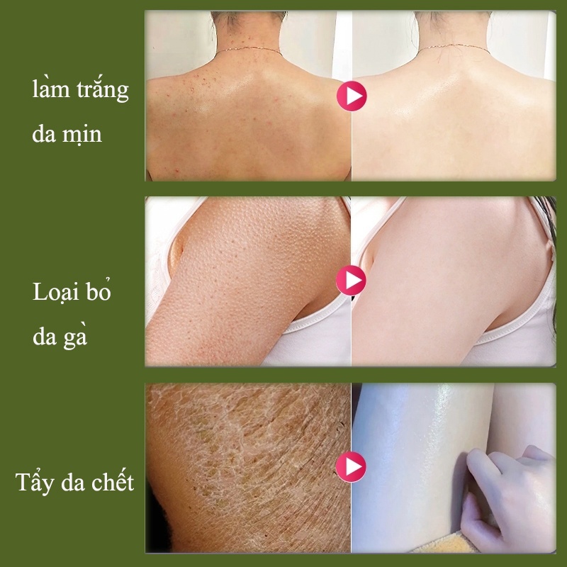 kem tẩy tế bào chết tẩy tế bào chết body 250g body toàn thân tắm trắng toàn thân kem body trắng làm trắng dưỡng thu nhỏ lỗ chân lông Dưỡng ẩm và cấp nước cho da