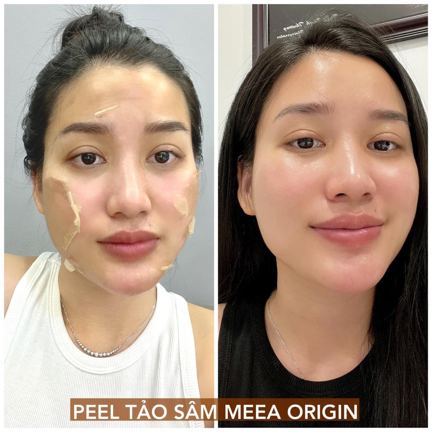 PEEL DA TẢO SÂM 36 VỊ - BÓC TÁCH TẢO SÂM ĐÔNG Y