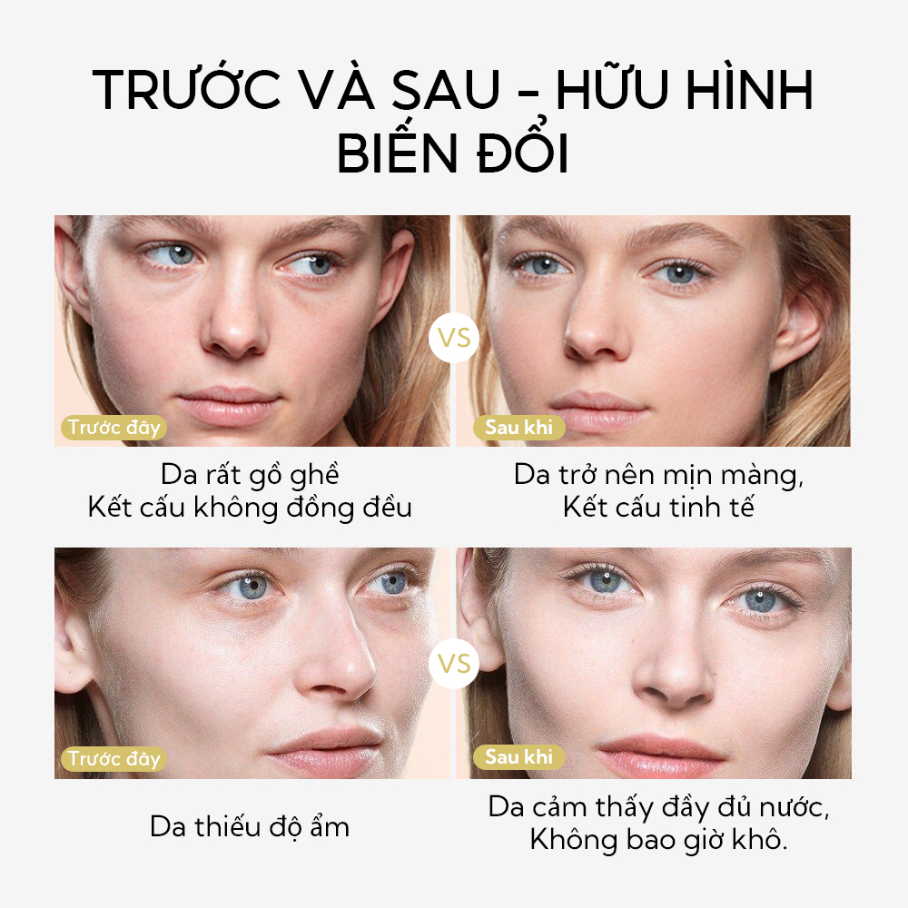 Chai Xịt Tẩy Tế Bào Chết Làm Sạch Da LANBENA 30ml