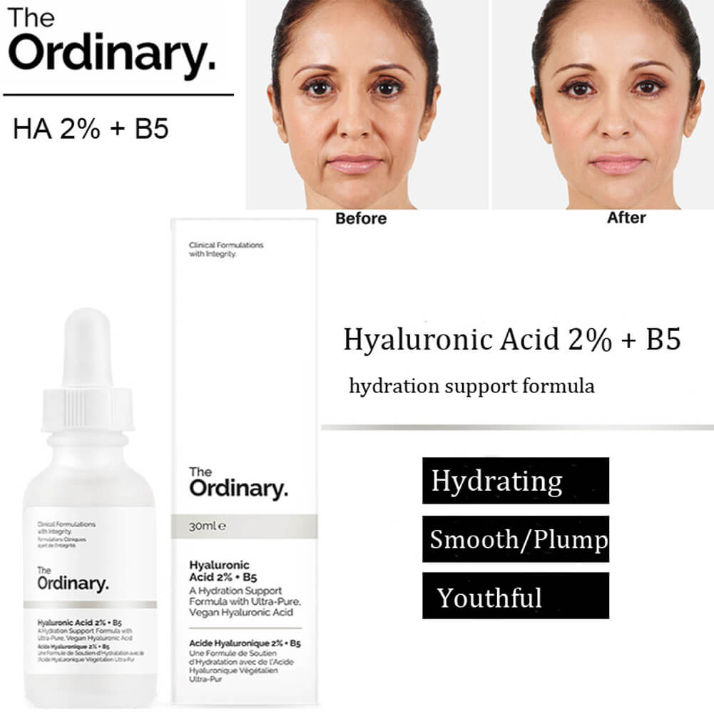 (Bản Canada) Cấp ẩm hồi phục Hyaluronic Acid 2% + B5 - The Ordinary