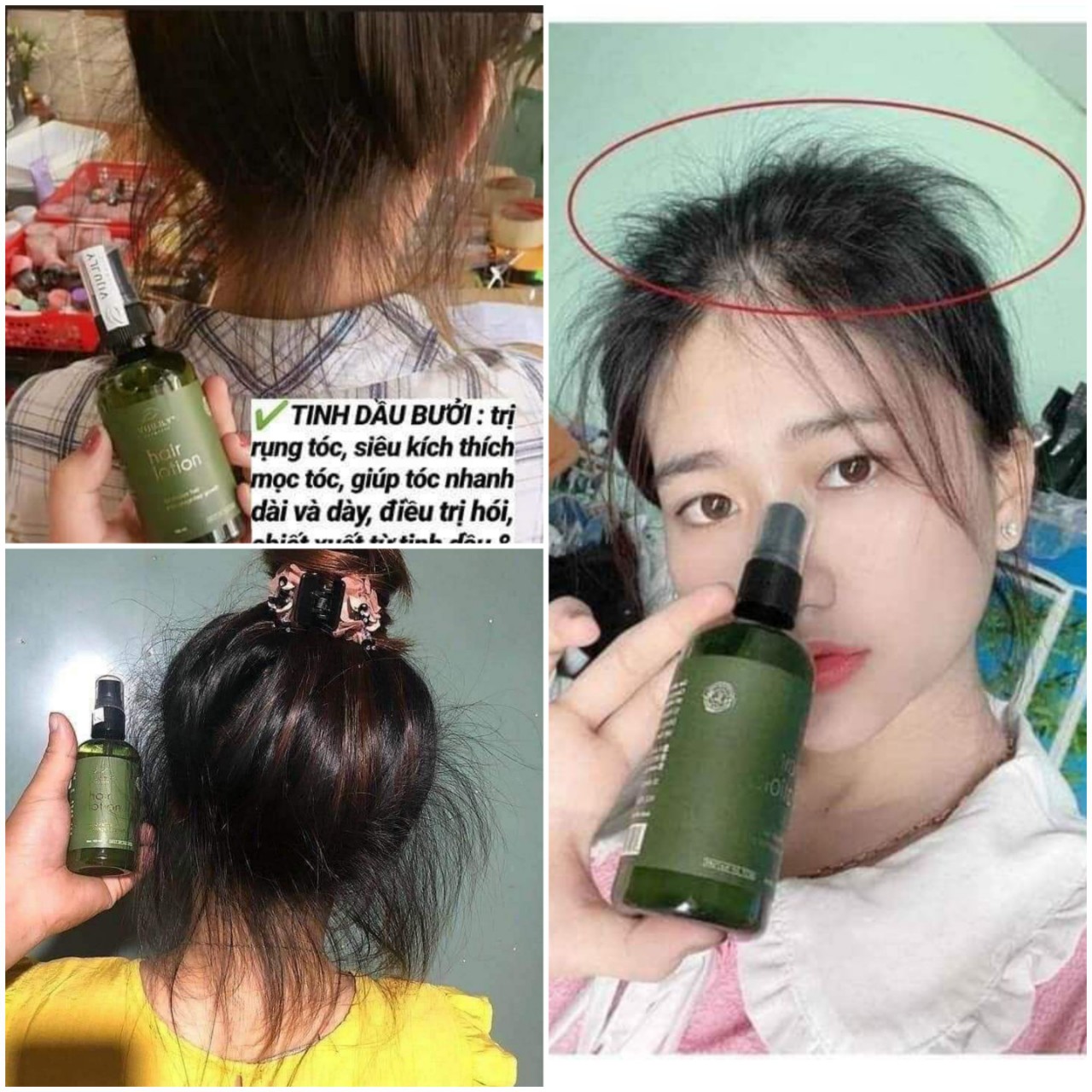 Xịt bưởi Vijully giúp kích mọc tóc và ngăn rụng tóc