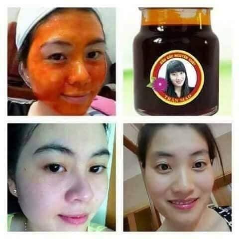 DẦU GẤC EP LẠNH TRẦN MAO 70ml