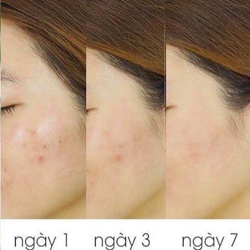 Sữa Rửa Mặt Caryophy Portulaca Cleansing Foam 3In1