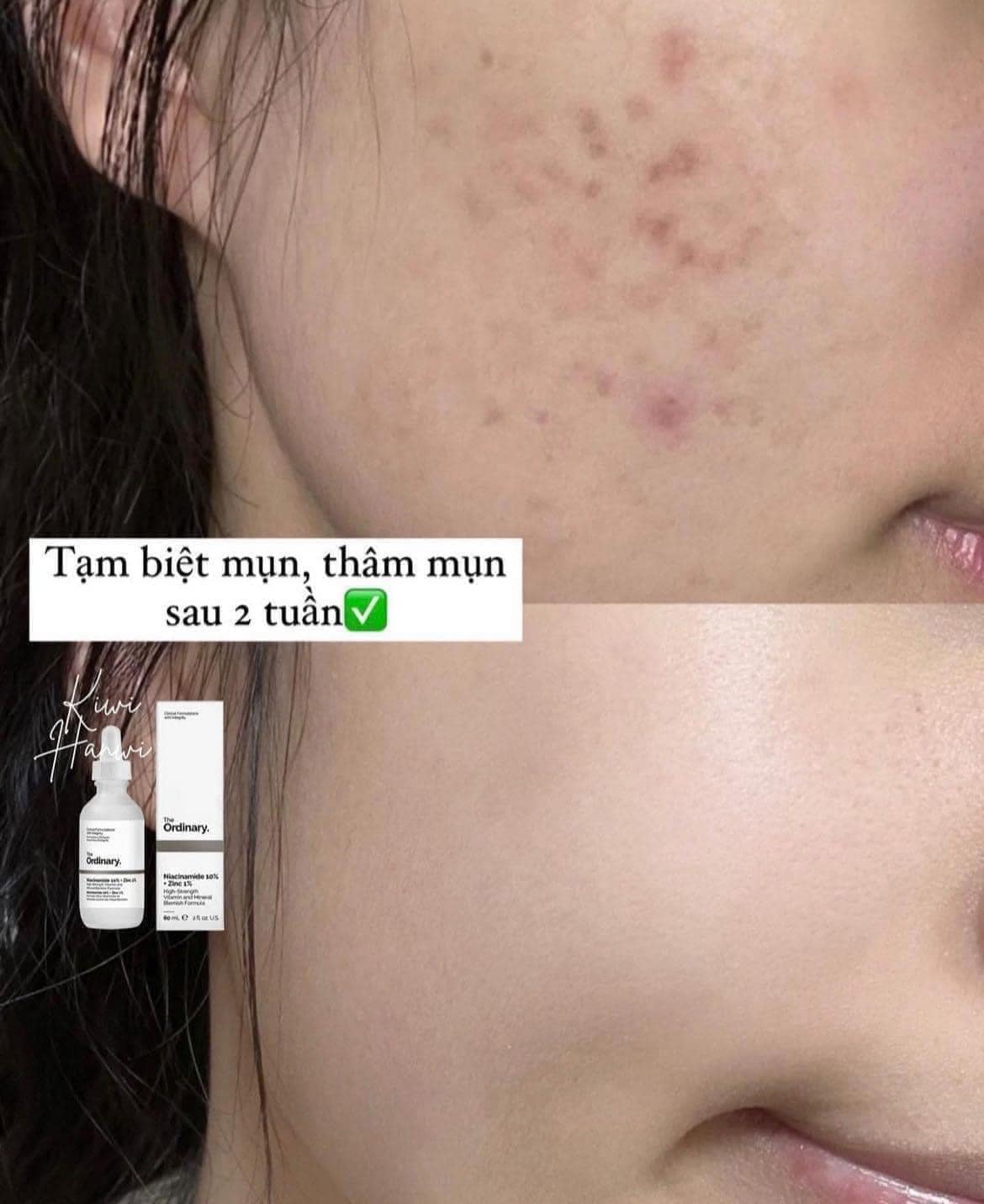 Serum the ordinary zin C