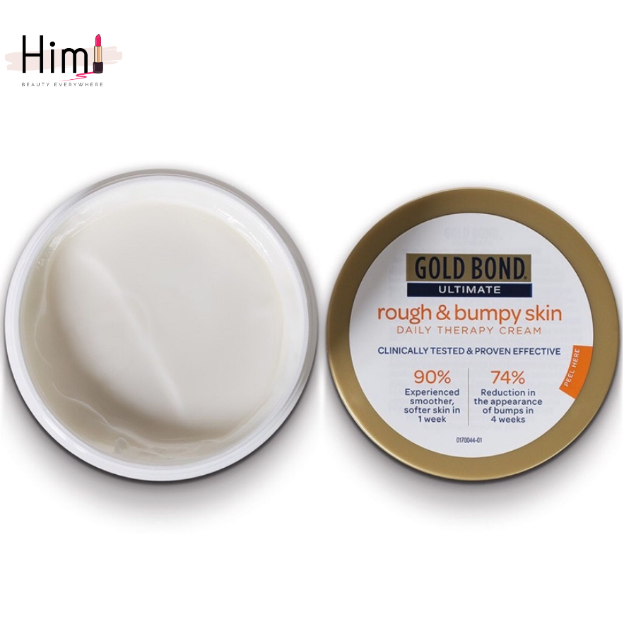 Kem dưỡng body cho da khô mụn Gold Bond [Bill Us]