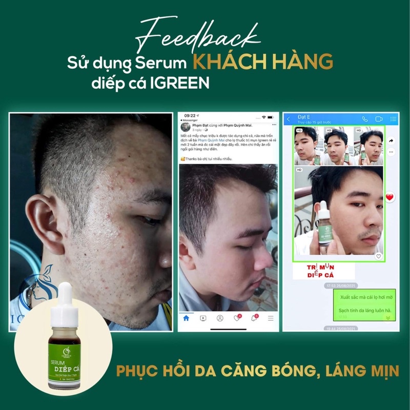 Serum Diếp Cá